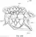 Fig. 51 - Methods and apparatus for delivering a prosthetic valve to a beating heart