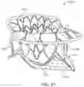 Fig. 52 - Methods and apparatus for delivering a prosthetic valve to a beating heart