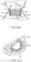Fig. 56 - Methods and apparatus for delivering a prosthetic valve to a beating heart
