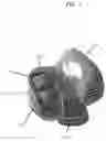 Fig. 02 - Early Intervention Knee Implant Device and Methods