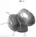 Fig. 06 - Early Intervention Knee Implant Device and Methods