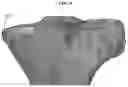 Fig. 09 - Early Intervention Knee Implant Device and Methods