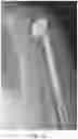 Fig. 03 - Adjustable orthopedic connections