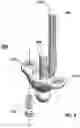 Fig. 09 - Total wrist prosthesis and related methods