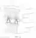 Fig. 06 - Spinal implant with expandable fixation