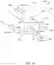 Fig. 02 - Staged laterovertical expansion