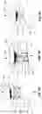 Fig. 09 - Systems and methods for adjacent vertebral fixation
