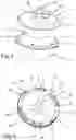 Fig. 06 - Device for positioning a resurfacing prosthesis and method of assembling said device