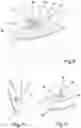 Fig. 07 - Device for positioning a resurfacing prosthesis and method of assembling said device