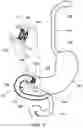 Fig. 02 - DELIVERY DEVICES AND METHODS FOR GASTROINTESTINAL IMPLANTS
