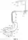 Fig. 03 - DELIVERY DEVICES AND METHODS FOR GASTROINTESTINAL IMPLANTS