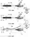 Fig. 46 - DELIVERY DEVICES AND METHODS FOR GASTROINTESTINAL IMPLANTS