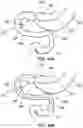 Fig. 49 - DELIVERY DEVICES AND METHODS FOR GASTROINTESTINAL IMPLANTS