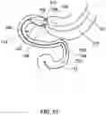 Fig. 52 - DELIVERY DEVICES AND METHODS FOR GASTROINTESTINAL IMPLANTS