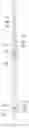 Fig. 01 - Intestinal barrier sleeve release system