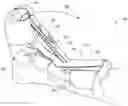 Fig. 01 - Adjustable dorsal night splint