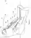 Fig. 02 - Adjustable dorsal night splint