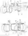 Fig. 02 - Orthopedic device having a dynamic control system and method for using the same