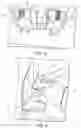 Fig. 04 - Arm restraint for surgery tables