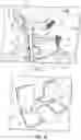 Fig. 05 - Arm restraint for surgery tables
