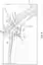 Fig. 07 - Scleral translocation elasto-modulation methods and apparatus