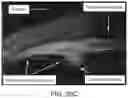 Fig. 35 - Scleral translocation elasto-modulation methods and apparatus