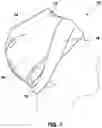 Fig. 02 - HEAD TRAUMA BANDAGE CAP AND METHOD