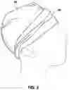 Fig. 03 - HEAD TRAUMA BANDAGE CAP AND METHOD