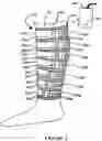 Fig. 03 - Compression garment apparatus