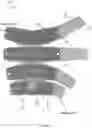 Fig. 03 - Compression garment
