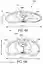 Fig. 07 - Systems and Methods for Providing Resuscitation Guidance based on Physical Features of a Patient Measured During an Acute Care Event