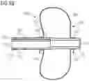 Fig. 07 - GASTROSTOMY DEVICE WITH AN IMPROVED RETAINING ELEMENT