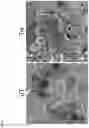 Fig. 06 - COMPOSITIONS AND METHODS FOR THE TREATMENT OF LYSOSOMAL STORAGE DISORDERS AND DISORDERS CHARACTERIZED BY LYSOSOMAL DYSFUNCTION