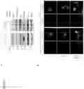 Fig. 16 - COMPOSITIONS AND METHODS FOR THE TREATMENT OF LYSOSOMAL STORAGE DISORDERS AND DISORDERS CHARACTERIZED BY LYSOSOMAL DYSFUNCTION