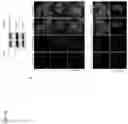 Fig. 17 - COMPOSITIONS AND METHODS FOR THE TREATMENT OF LYSOSOMAL STORAGE DISORDERS AND DISORDERS CHARACTERIZED BY LYSOSOMAL DYSFUNCTION