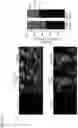 Fig. 20 - COMPOSITIONS AND METHODS FOR THE TREATMENT OF LYSOSOMAL STORAGE DISORDERS AND DISORDERS CHARACTERIZED BY LYSOSOMAL DYSFUNCTION