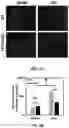 Fig. 03 - Methods for treating ischemic heart disease by targeting TRPV4