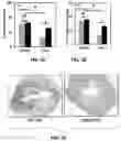 Fig. 04 - Methods for treating ischemic heart disease by targeting TRPV4