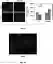 Fig. 06 - Methods for treating ischemic heart disease by targeting TRPV4