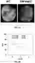 Fig. 08 - Methods for treating ischemic heart disease by targeting TRPV4