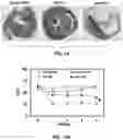 Fig. 16 - Methods for treating ischemic heart disease by targeting TRPV4
