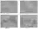 Fig. 05 - Pharmaceutical composition for improving health, cure abnormalities and degenerative disease, achieve anti-aging effect of therapy and therapeutic effect on mammals and method thereof