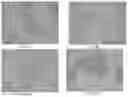 Fig. 06 - Pharmaceutical composition for improving health, cure abnormalities and degenerative disease, achieve anti-aging effect of therapy and therapeutic effect on mammals and method thereof