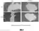 Fig. 05 - PLATELET RICH PLASMA FORMULATIONS