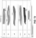 Fig. 11 - Methods of treating tissue voids following removal of implantable infusion ports using adipose tissue products