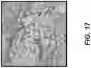 Fig. 16 - Methods of treating tissue voids following removal of implantable infusion ports using adipose tissue products
