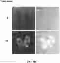 Fig. 13 - PEPTIDES AND METHODS OF TREATING DYSTROPHY-RELATED DISORDERS USING THE SAME