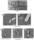 Fig. 08 - Injectable self-assembling antibacterial peptide hydrogels