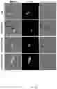 Fig. 06 - Bioengineered lactobacillus probiotics and the uses thereof
