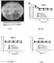 Fig. 08 - Bioengineered lactobacillus probiotics and the uses thereof